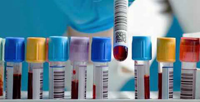 روش های درمان تب مالت یا بروسلوز