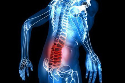 بیماری استخوان | پوکی استخوان